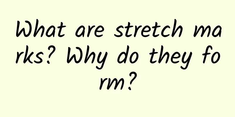 What are stretch marks? Why do they form?
