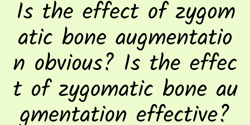 Is the effect of zygomatic bone augmentation obvious? Is the effect of zygomatic bone augmentation effective?