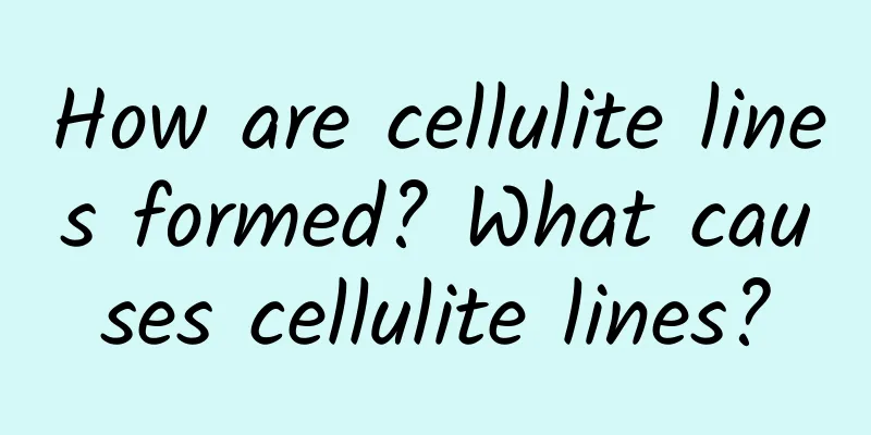 How are cellulite lines formed? What causes cellulite lines?