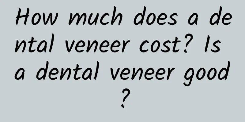 How much does a dental veneer cost? Is a dental veneer good?