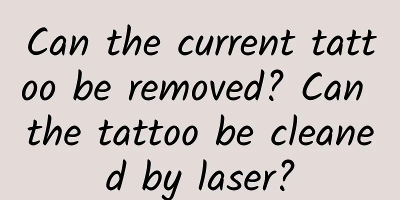Can the current tattoo be removed? Can the tattoo be cleaned by laser?