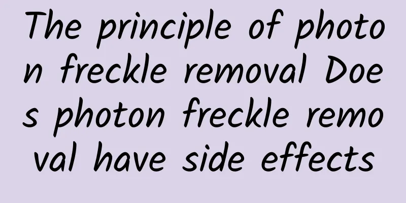 The principle of photon freckle removal Does photon freckle removal have side effects