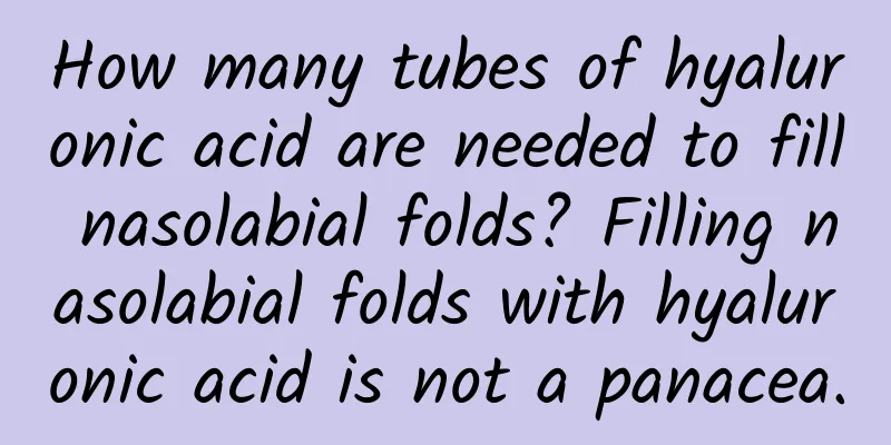 How many tubes of hyaluronic acid are needed to fill nasolabial folds? Filling nasolabial folds with hyaluronic acid is not a panacea.