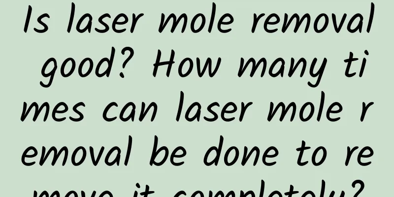 Is laser mole removal good? How many times can laser mole removal be done to remove it completely?