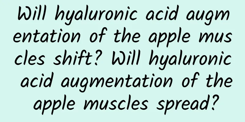Will hyaluronic acid augmentation of the apple muscles shift? Will hyaluronic acid augmentation of the apple muscles spread?