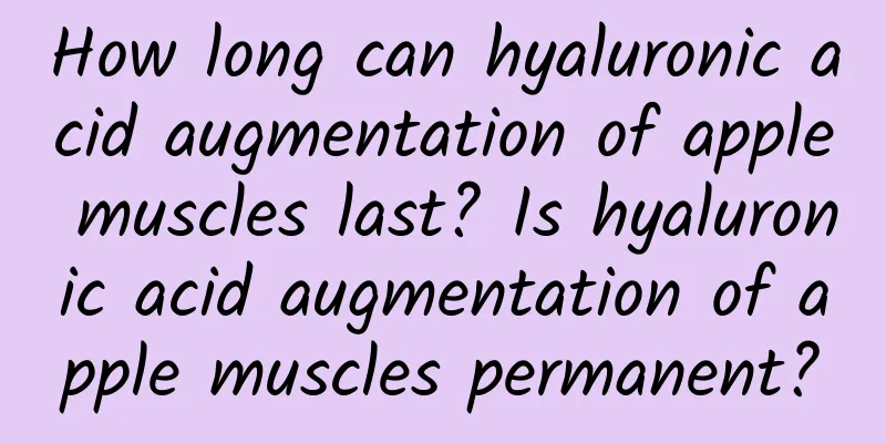 How long can hyaluronic acid augmentation of apple muscles last? Is hyaluronic acid augmentation of apple muscles permanent?