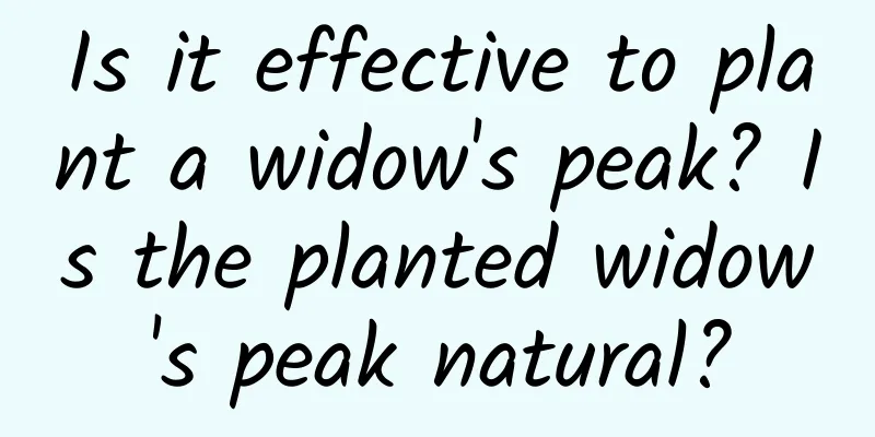 Is it effective to plant a widow's peak? Is the planted widow's peak natural?