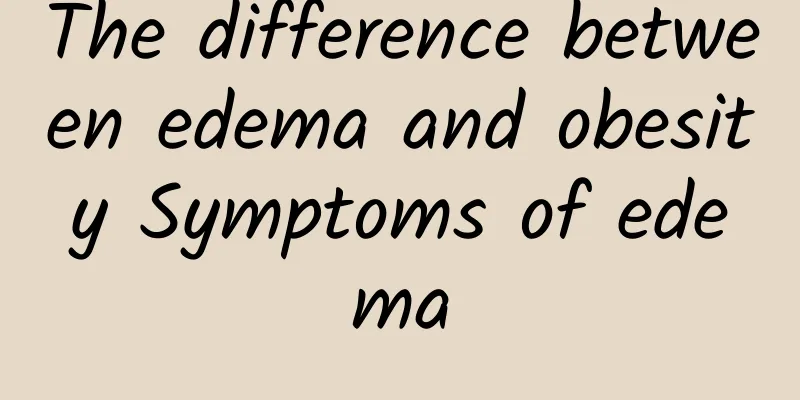 The difference between edema and obesity Symptoms of edema