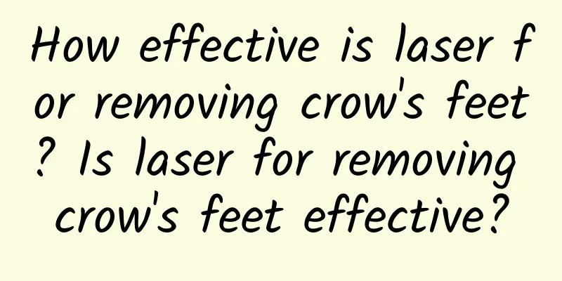 How effective is laser for removing crow's feet? Is laser for removing crow's feet effective?