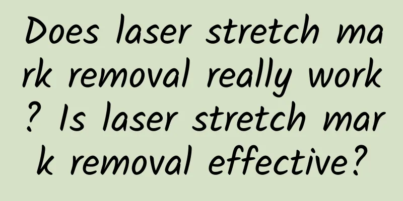 Does laser stretch mark removal really work? Is laser stretch mark removal effective?