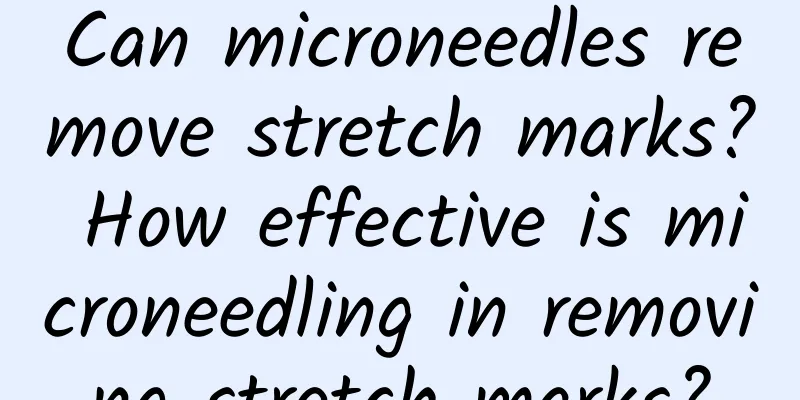 Can microneedles remove stretch marks? How effective is microneedling in removing stretch marks?